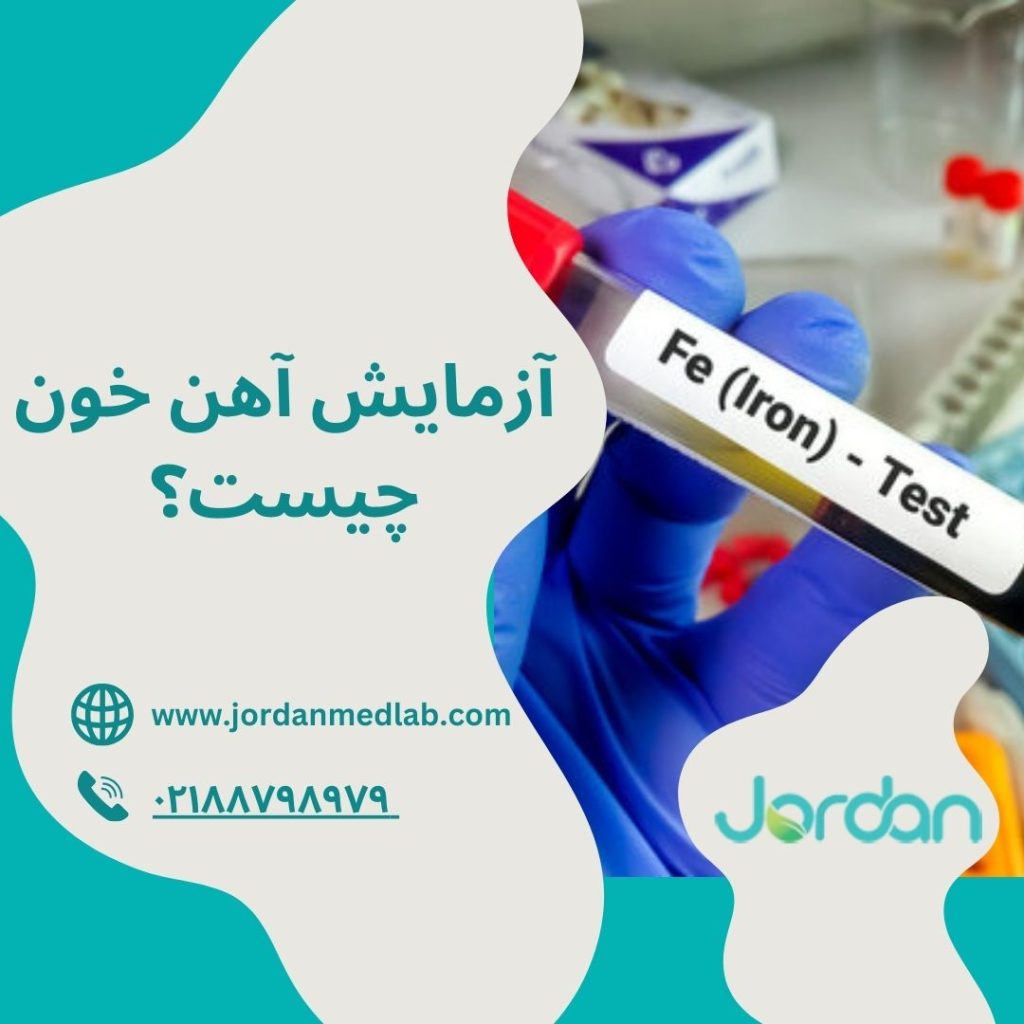 آزمایش آهن خون 