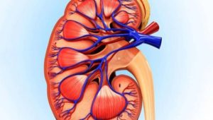 سندرم آلپورت سندرم آلپورت