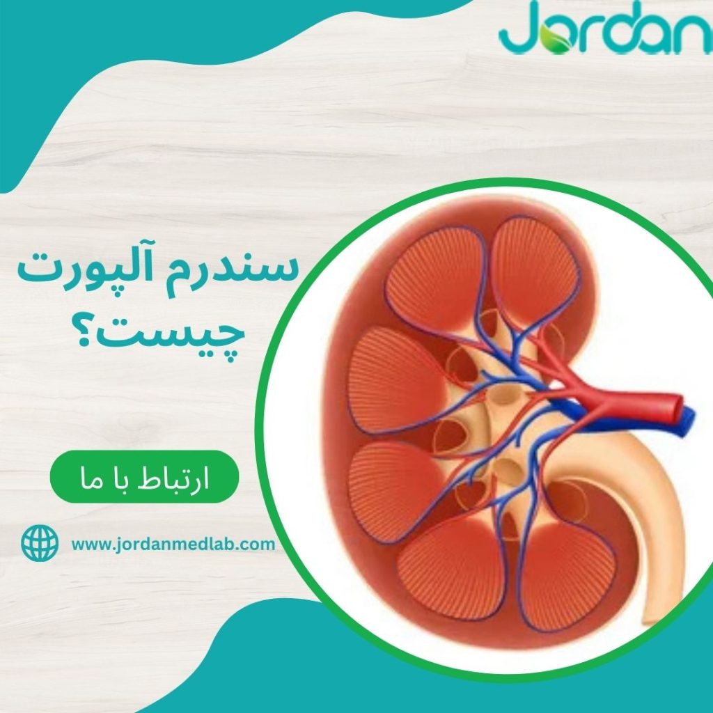سندرم آلپورت