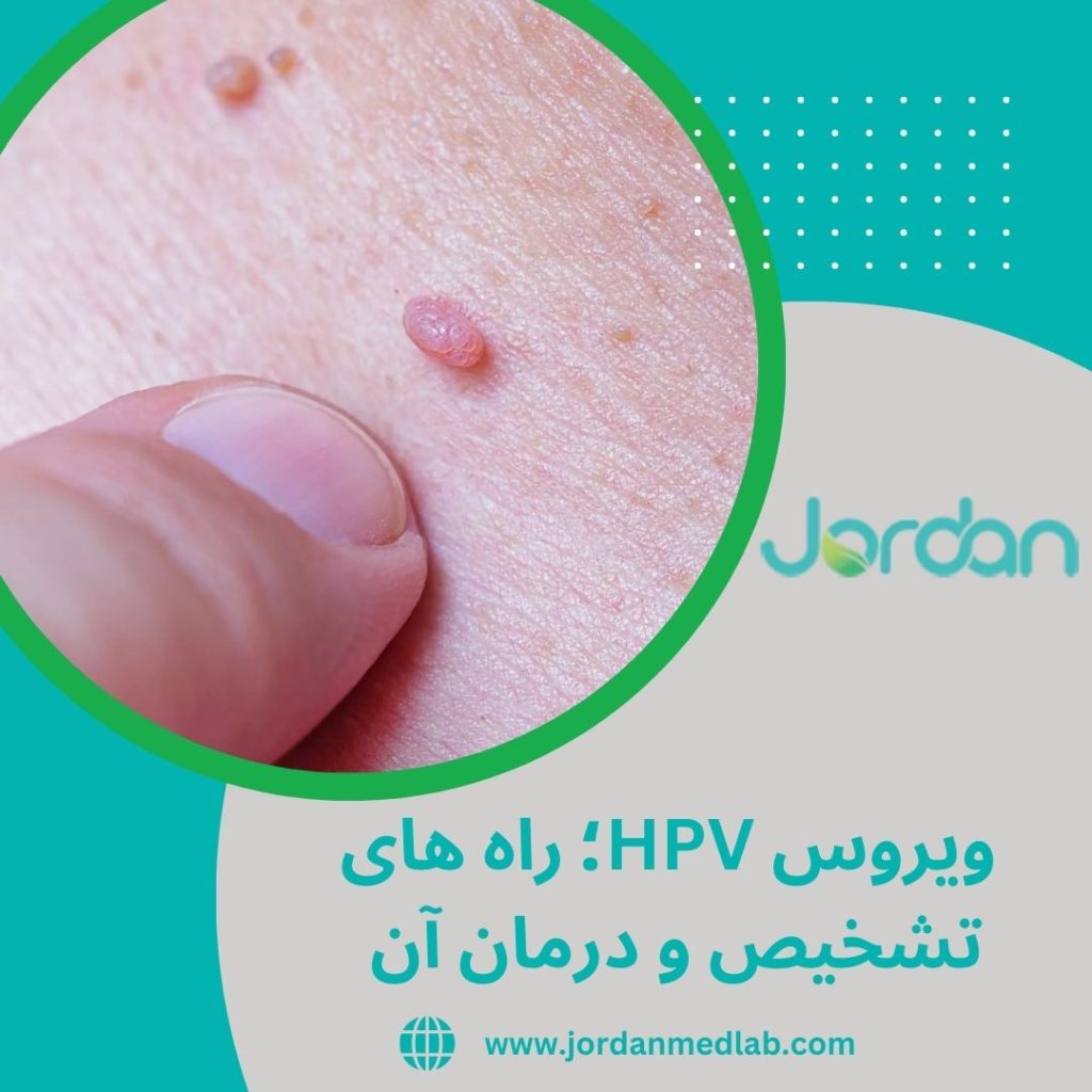 ویروس HPV