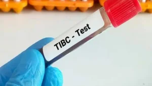 آزمایش TIBC