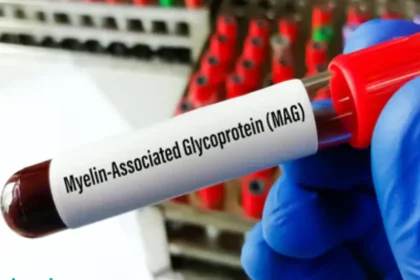 آزمایش آنتی بادی MAG