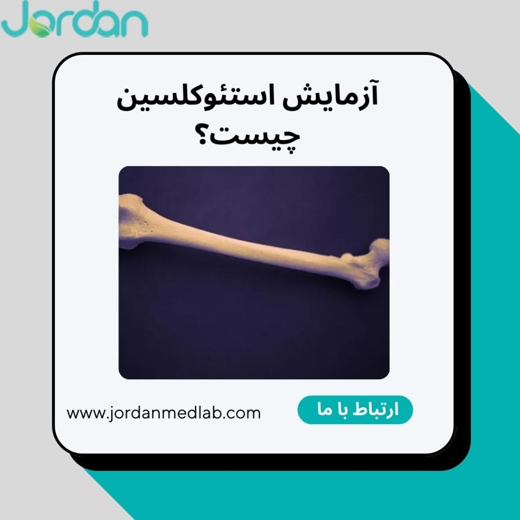 آزمایش استئوکلسین
