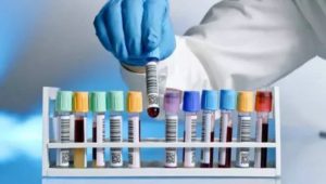 آزمایش پانل متابولیک جامع