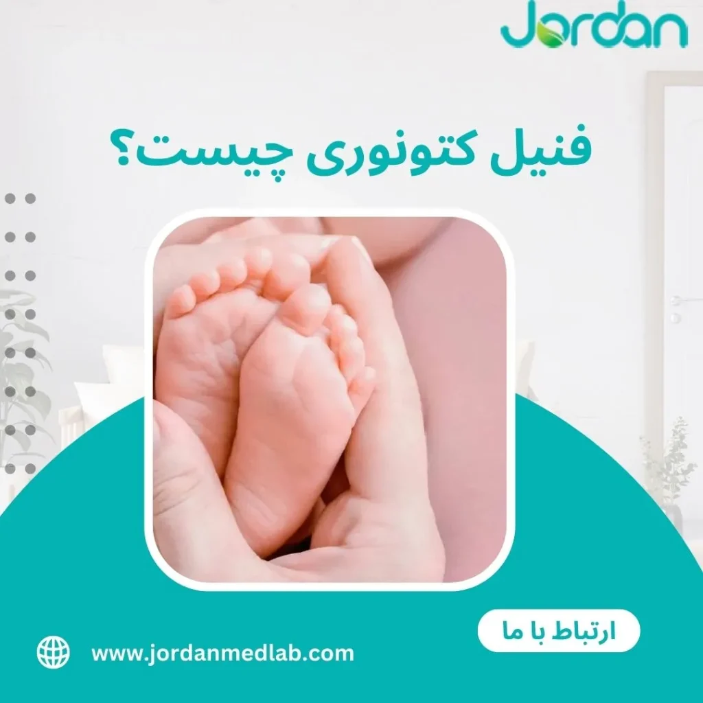 فنیل کتونوری