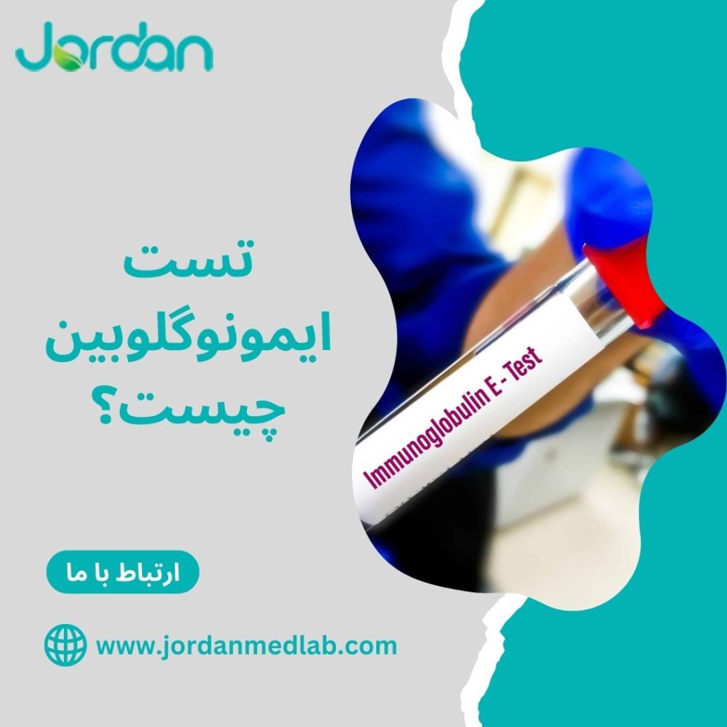 تست ایمونوگلوبین 