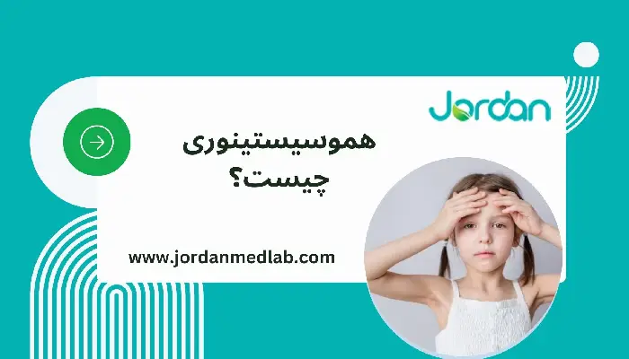 هموسیستینوری 