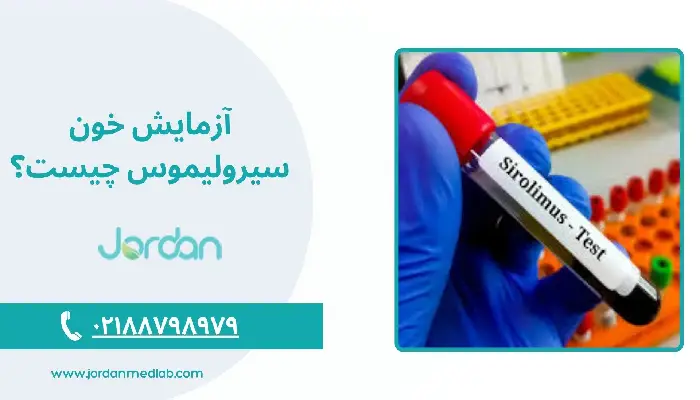 آزمایش سیرولیموس