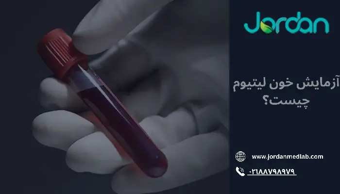 آزمایش خون لیتیوم