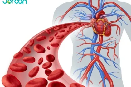 آزمایش هموسیستئین