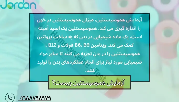 آزمایش هموسیستئین