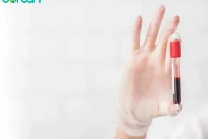بهترین آزمایشگاه hpv در تهران