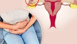 بارداری خارج رحمی