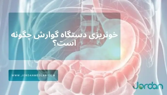 خونریزی دستگاه گوارش