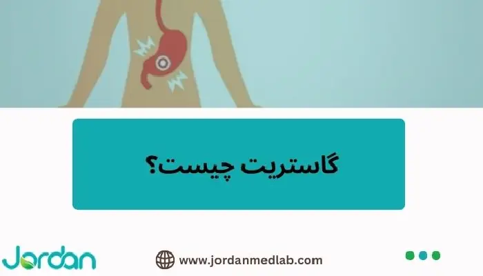 گاستریت