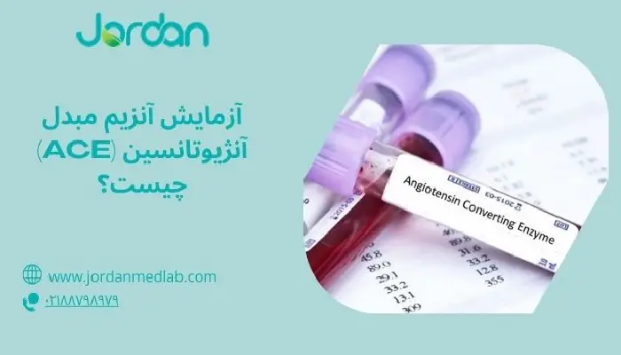 آزمایش ACE