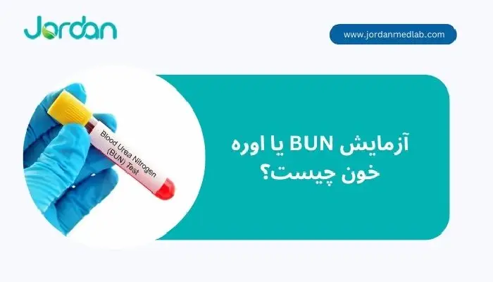 آزمایش BUN