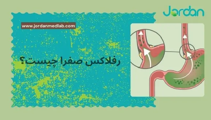 رفلاکس صفرا