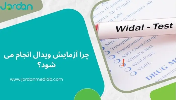 آزمایش ویدال