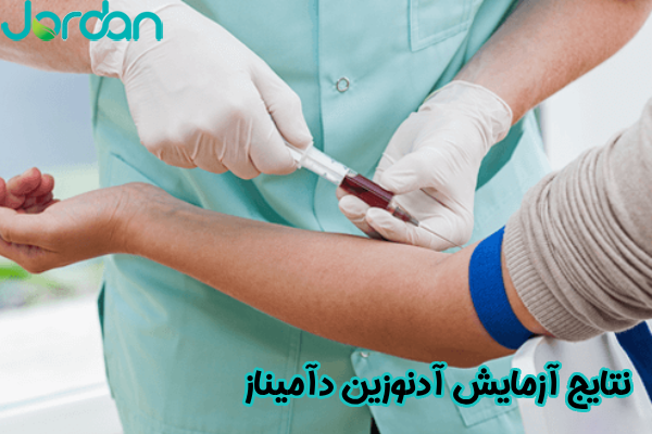 نتایج آزمایش آدنوزین دآمیناز