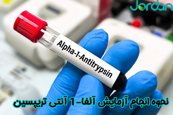 نحوه انجام آزمایش آلفا-1 آنتی تریپسین