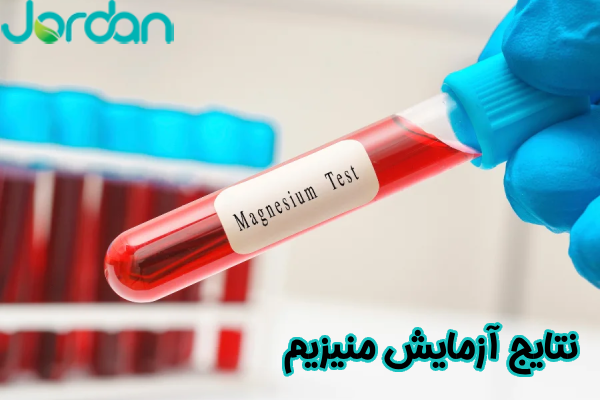 نتایج آزمایش منیزیم