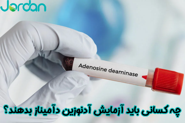 چه کسانی باید آزمایش آدنوزین دآمیناز بدهند؟