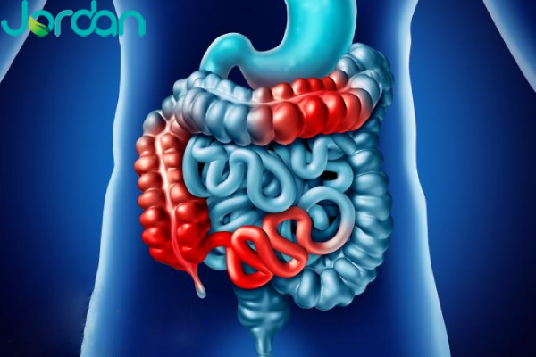 علل بیماری کرون
