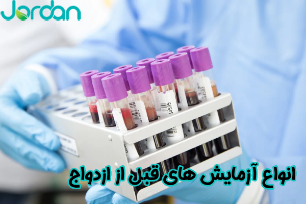 انواع آزمایش‌ های قبل از ازدواج