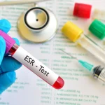 آزمایش ESR