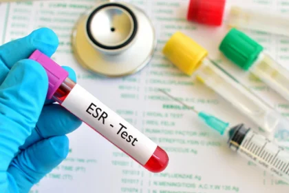 آزمایش ESR