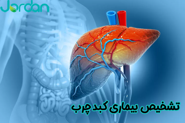 تشخیص بیماری کبد چرب