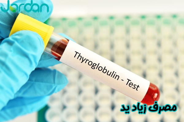 مصرف زیاد ید