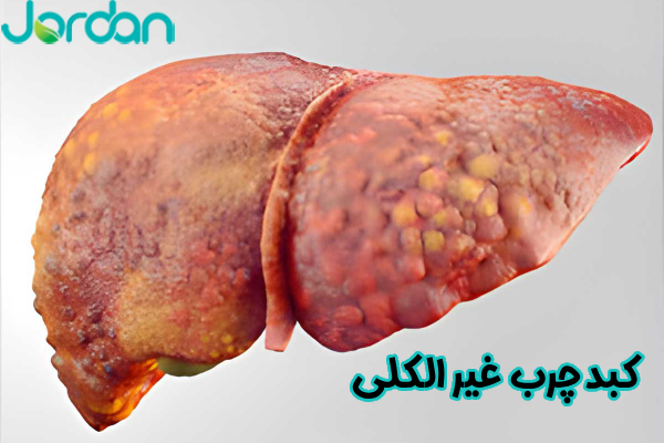 کبد چرب غیرالکلی