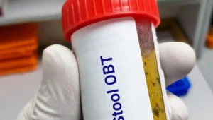 Occult-blood-in-stool-test خون مخفی در آزمایش مدفوع