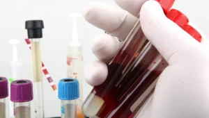 Pre-surgery-tests آزمایشهای قبل از جراحی