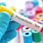 تست پروکلسیتونین