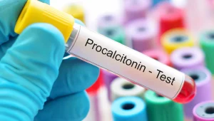 Procalcitonin-test تست پروکلسیتونین