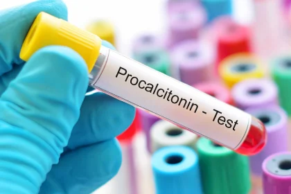 تست پروکلسیتونین