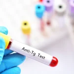 آزمایش آنتی بادی تیروگلوبولین