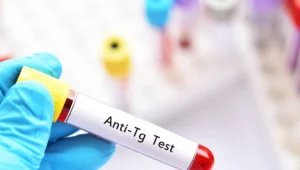 Thyroglobulin-antibody-test آزمایش آنتی بادی تیروگلوبولین