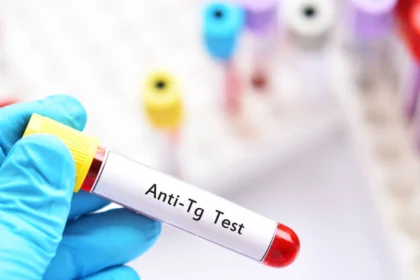 آزمایش آنتی بادی تیروگلوبولین
