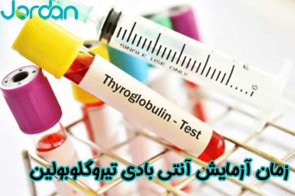 زمان آزمایش آنتی بادی تیروگلوبولین