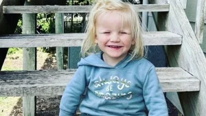 Turner-syndrome سندرم ترنر