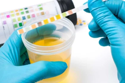 آزمایش ادرار برای دیابت