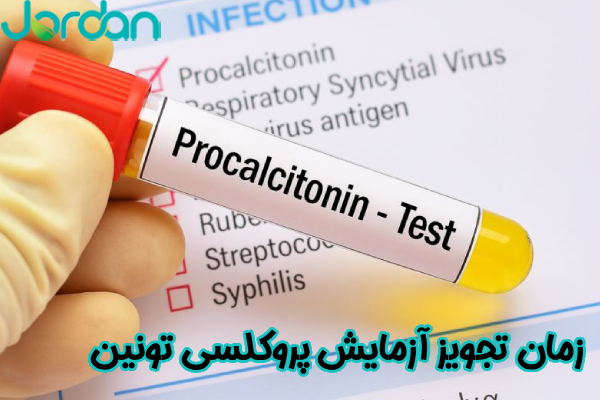 زمان تجویز آزمایش پروکلسی تونین