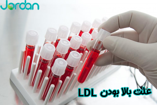 علت بالا بودن LDL