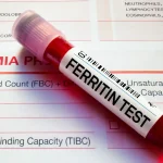 آزمایش Ferritin