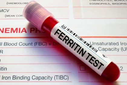 آزمایش Ferritin