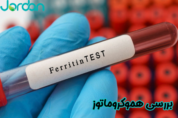 بررسی هموکروماتوز